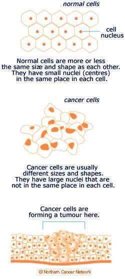 How does cancer do that? Sizing up cells and their shapes